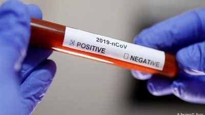 الصين: لن نرسل مسؤولين إلى اجتماع مجموعة العشرين وسط تفشي كورونا