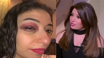 غادة رجب تتصدر 