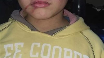 نكشف تفاصيل جديدة في واقعة تعذيب الطفل محمد بكفر الشيخ