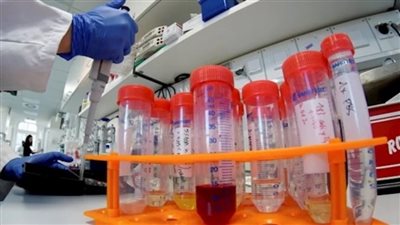 الصحة الإيرلندية تعلن تسجيل 6 إصابات جديدة بفيروس كورونا