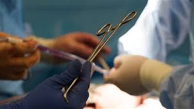 برلماني يكشف عقوبة سرقة الأعضاء البشرية