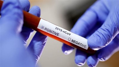 الصحة التونسية تعلن تسجيل 3 إصابات جديدة بفيروس كورونا