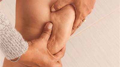 أطعمة ومشروبات تساعد في القضاء على السيلوليت 