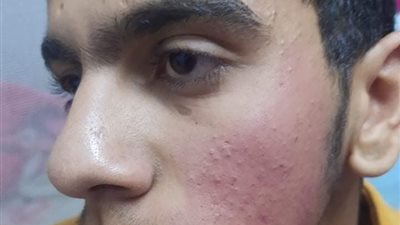 ضحك مع زملائه.. مدرس يعتدي على طالب بـ