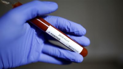 تسجيل أول حالة وفاة بفيروس كورونا في بلجيكا