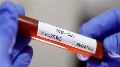 أمين الأعلى للمستشفيات الجامعية يوجه نصيحة ذهبية للوقاية من كورونا