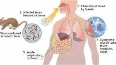 في نقاط ما هو الفرق بين هانتا وكورونا