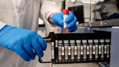 لها مضاعفات خطيرة.. وكالة الدواء الأوروبية تحذر من استخدام دواء الملاريا علاج لـ 