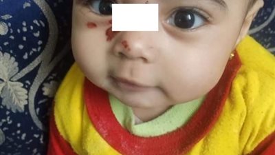 قرار جديد للنيابة بشأن واقعة تعذيب طفلة على يد والدتها في إمبابة