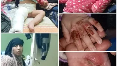 بعد خلاف 4 سنوات.. عمة 