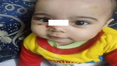 أخوها مفيهوش خدش.. والدة الطفلة سجدة: '