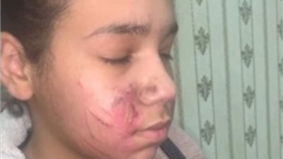  تفاصيل تعذيب الطفلة 