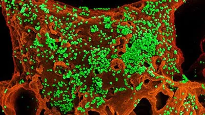 طبيب يكشف مفاجأة صادمة بشأن كورونا (فيديو)
