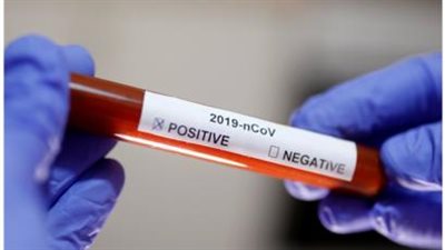 الهند تعتزم إنتاج 60 مليون جرعة لقاح ضد فيروس كورونا