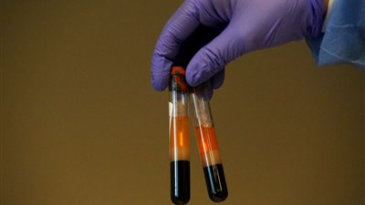 فرنسا تسمح بشروط استخدام أمصال 