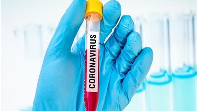 تعرف على آخر مستجدات إنتاج علاج كورونا المصري