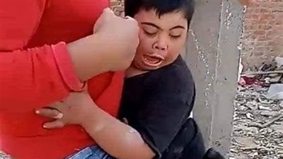 قرار جديد من النائب العام في واقعة ترويع طفل معاق بكلب مفترس