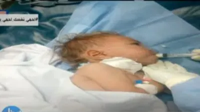 أهله ميعرفوش.. تفاصيل إصابة طفل عمره عامين بكورونا في الدقهلية (فيديو)