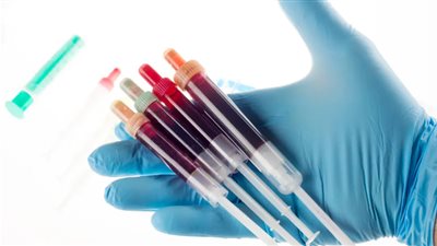 ما هي فصائل الدم الأكثرعُرضة للإصابة بكورونا؟