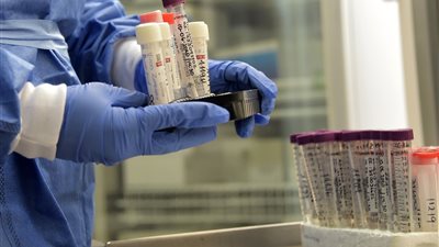 حصيلة الإصابة بكورونا عالمياً تتخطي حاجز 10 ملايين