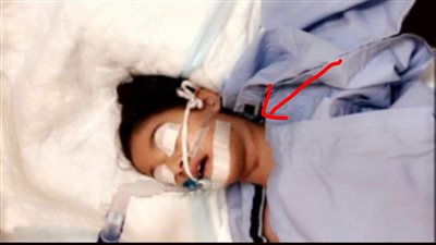 والد الطفل ضحية التيك توك: 