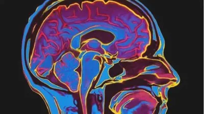 معلومات خطيرة من كبار الأطباء.. هل يتسبب كورونا في التلف الدماغي؟