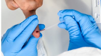 تمنع تكرار الإصابة.. تعرف على أهم الأجسام المضادة لفيروس كورونا