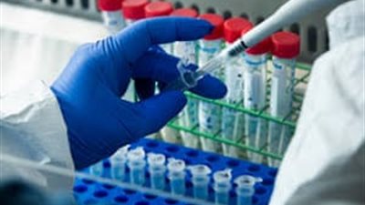 متى ينتهي الصداع المزمن وينتج العالم لقاح ضد كورونا؟ 