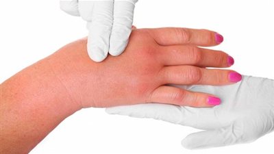 6 نصائح هامة لمعالجة احتباس الماء في الجسم