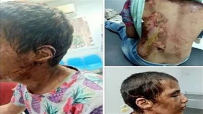 شاهد.. محافظ كفر الشيخ: الطفلة أمنية تحتاج دعما نفسيا قويا 