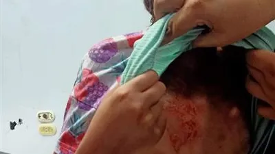 محافظ كفر الشيخ يتابع علاج الطفلة 