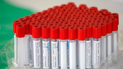 السعودية تسجل 1060 حالة شفاء من فيروس كورونا