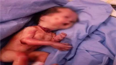 مشادة بين أم الطفل المذبوح ورئيس قسم النساء بمستشفى أرمنت (فيديو)