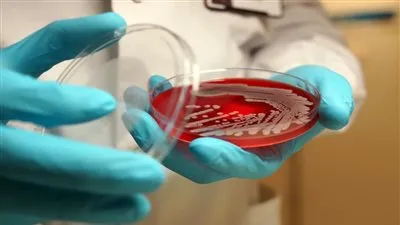 أعراضها وطرق الوقاية منها.. كل ما تريد معرفته عن بكتيريا مارسا