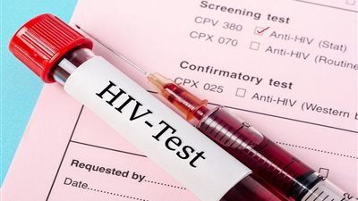 في يومه العالمي.. كيف تصدت مصر للإيدز طوال 2020؟