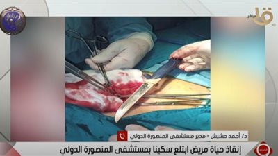 مدير مستشفى المنصورة يكشف تفاصيل إنقاذ حياة مريض ابتلع سكينا (فيديو)