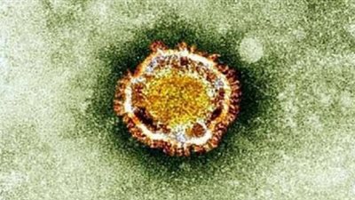 بعد التحذير منه.. تعرف على أعراض فيروس نيباه الفتاك