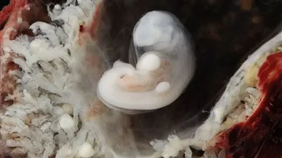 تعرف على أول ألبوم لجنين من داخل رحم الأم 