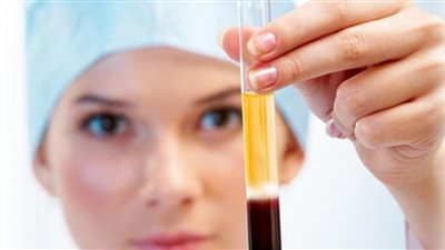 3 مراحل.. تفاصيل تصنيع مشتقات بلازما الدم في مصر 