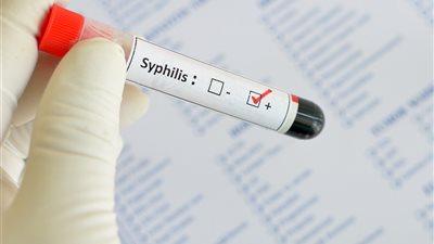 مراحله وطرق علاجه.. كل ما تريد معرفته عن مرض الزهري