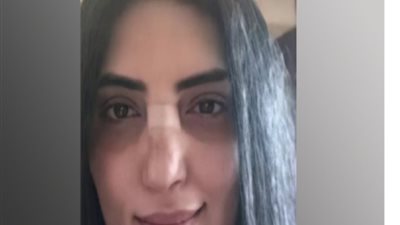 حورية فرغلي تعلق على صورة تزعم خضوعها لعملية جراحية.. فماذا قالت؟