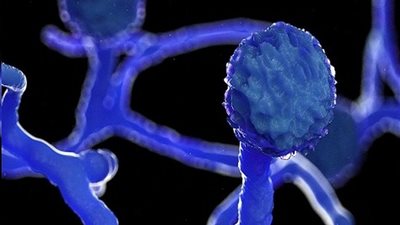 ليس الفطر الأسود فقط.. أستاذ علم الأحياء الدقيقة يكشف مفاجأة أخرى في الهند (فيديو)