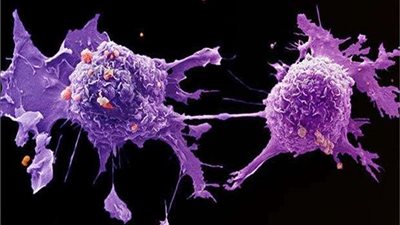 طبيب: تطعيم 70% من المصريين بلقاح كورونا يحقق مناعة القطيع (فيديو)