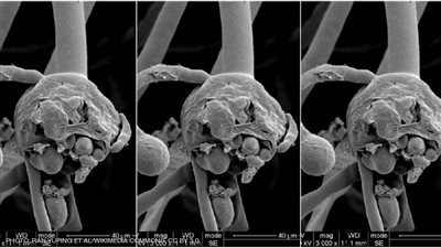 لا خطورة ولا إصابات.. مفاجآت عن الفطر الأسود بمصر