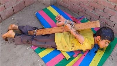 التحقيق في واقعة تعذيب طفل بـ