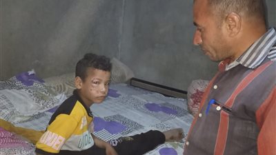 الوحدة المحلية والطب البيطري بإبشواي يشنون حملة للقضاء على الكلاب الضالة والمسعورة (صور)