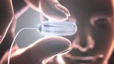 استشاري: الكبسولة المبرمجة تستمر داخل المعدة 4 شهور وتُهضم  