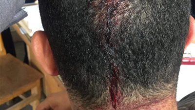 7 جنيهات زيادة.. سائق يتعدى على راكب بسبب الأجرة 