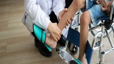 مدير معهد ناصر: حصر 60 حالة لتلقي علاج الضمور العضلي في 126 عيادة 