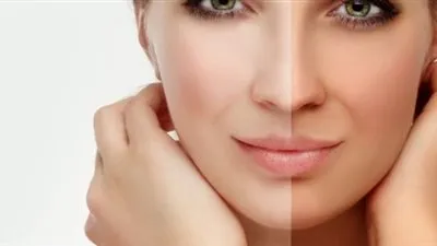 أخصائية جلدية تكشف أحدث الطرق لعلاج توحيد البشرة 